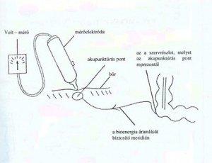 forrás: Voll diagnosztika honlapja